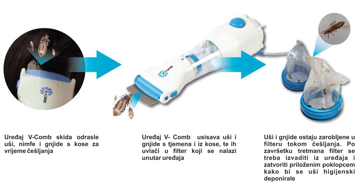 ELEKTRIČNI Češalj i Usisivač PROTIV Vaši i drugih insekata!